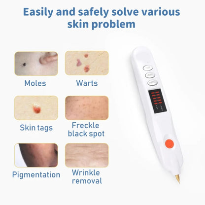 Spot Mole Pen Spot Removal Instrument Home Beauty Instrument, Spec: Charging Model US Plug(Golden) - Beauty Instrument by buy2fix | Online Shopping UK | buy2fix